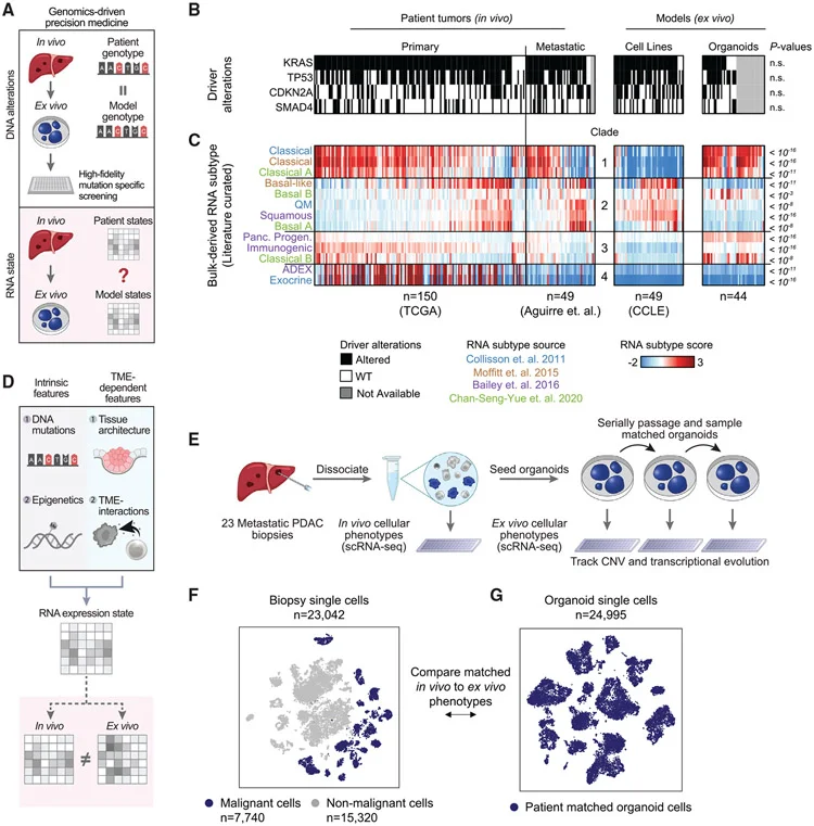Assessing transcriptional states in patient tumors and cancer models (A) Precision medicine pipelines assess model fidelity for genetics but typically do not evaluate RNA states. (B) Alterations in PDAC driver genes across primary resections (TCGA), metastatic biopsies (Panc-Seq), and organoid and cell line (CCLE) models. Grey indicates where genomic data were not available. P -values by Fisher’s exact test. (C) Comparison of PDAC expression signatures from bulk RNA-sequencing in primary and metastatic tumors, cell lines, and organoid models in (B). Rows are clustered, columns are sorted by average basal-classical score difference. P -values indicate differences between patient tumors, cell lines, and organoids by ANOVA. (D) Schematic of contributors to RNA state that may lead to differences between in vivo and ex vivo expression patterns. (E) Metastatic patient samples were collected via core needle biopsies and dissociated. Biopsy cells were allocated for scRNA-seq, and patient-matched organoids were developed with downstream serial scRNA-seq sampling. (F and G) t -distributed stochastic neighbor embedding ( t -SNE) for biopsy (F) and matched patient-derived organoid cells (G). See also Figure S1 ; Tables S1 and S2 .