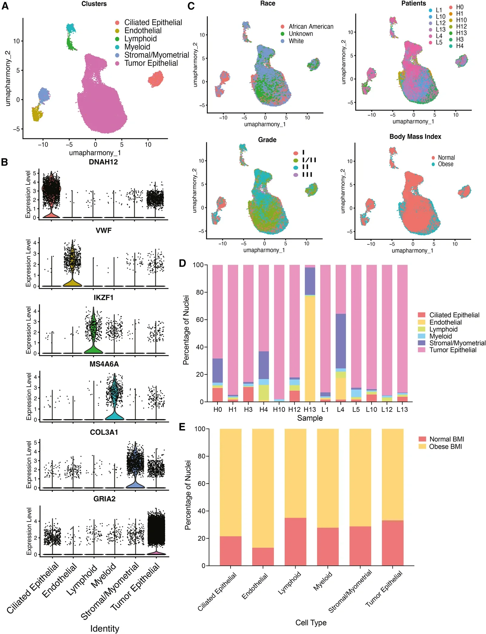 Single-nuclei characterization of endometrioid adenocarcinoma (A) UMAP of 42,574 nuclei from 13 primary tumors, colored and labeled by six major cell types: ciliated epithelial, endothelial, lymphoid, myeloid, stromal/myometrial, and tumor epithelial. (B) Expression of canonical marker genes for cluster annotation: DNAH12 (ciliated epithelium), VWF (endothelium), IKZF1 (lymphoid), MS4A6A (myeloid), COL3A1 (stromal/myometrial), and GRIA2 (tumor epithelial). (C) UMAPs visualizing the integrated dataset colored by clinical and pathological variables (race, patient of origin, tumor grade, BMI) to assess potential batch effects. (D) Composition of each tumor sample by cluster. (E) Distribution of body mass index group across each identified cluster. n = 13 tumors (7 obese, 6 normal-weight), 42,574 nuclei total. No formal statistical tests applied. See also Figures S1 , S2 , S3 , S4 , and S5 .